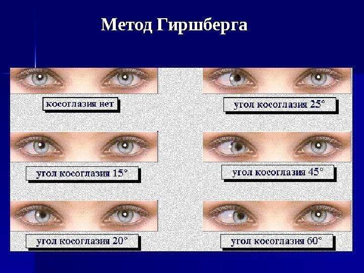     Метод Гиршберга  