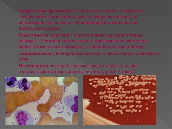   Морфология, физиологи:  Yersinia enterocolitica- возбудитель энтероколита-грамотрицательные подвижные палочки, не образующие спор