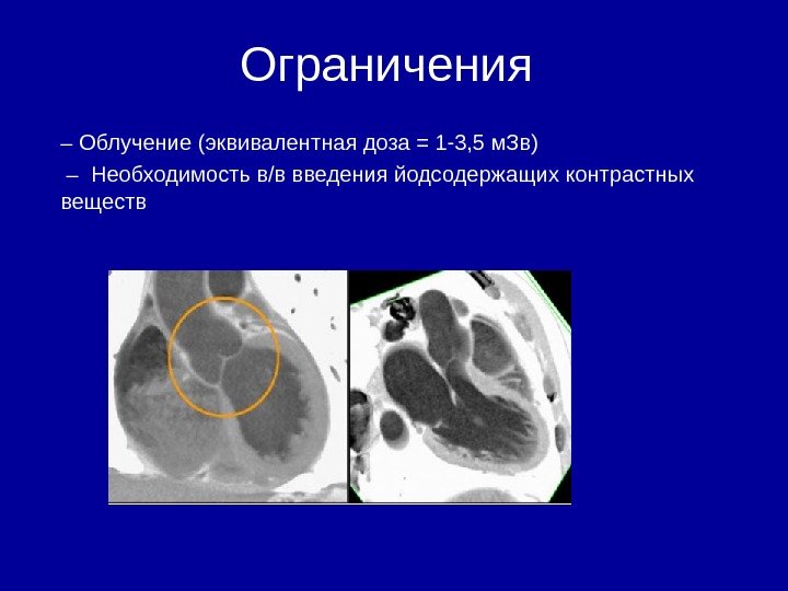      Ограничения – Облучение (эквивалентная доза = 1 -3, 5