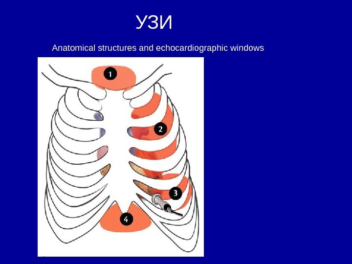 УЗИ Anatomical structures and echocardiographic windows 
