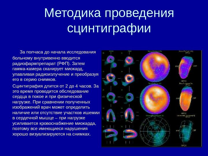 Методика проведения сцинтиграфии За полчаса до начала исследования больному внутривенно вводится радиофармпрепарат (РФП). Затем