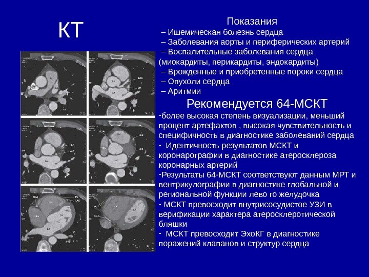 КТ     Показания – Ишемическая болезнь сердца – Заболевания аорты и