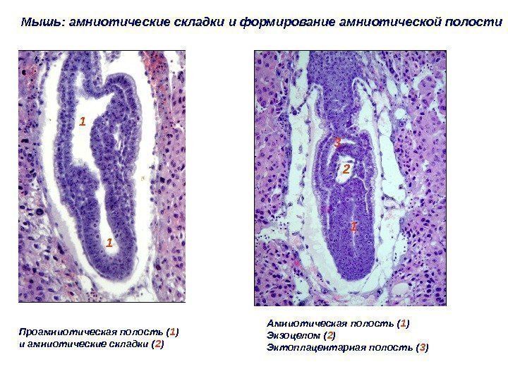 Мышь: амниотические складки и формирование амниотической полости Проамниотическая полость ( 1 ) и амниотические