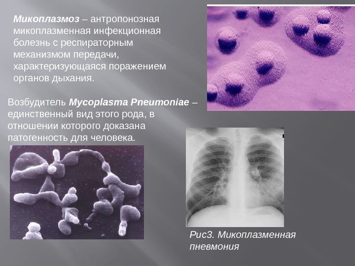 Микоплазмоз – антропонозная микоплазменная инфекционная болезнь с респираторным механизмом передачи,  характеризующаяся поражением органов