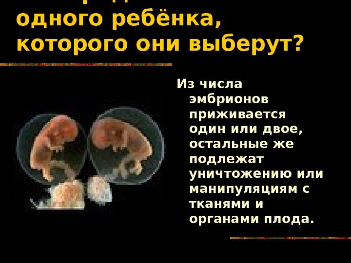   Если родители захотят одного ребёнка,  которого они выберут? Из числа эмбрионов