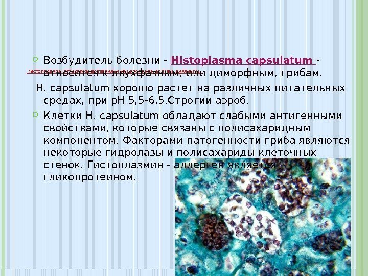  ГИСТОПЛАЗМОЗ (РЕТИКУЛОЭНДОТЕЛИАЛЬНЫЙ ЦИТОМИКОЗ, БОЛЕЗНЬ ДАРЛИНГА).  Возбудитель болезни - Histoplasma capsulatum - 