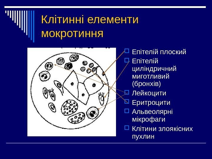 Клітинні елементи мокротиння Епітелій плоский Епітелій циліндричний миготливий (бронхів) Лейкоцити Еритроцити Альвеолярні мікрофаги Клітини