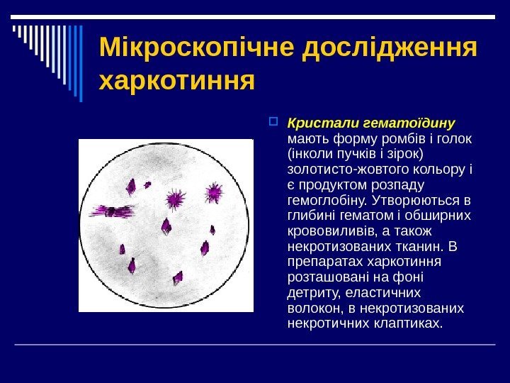 Мікроскопічне дослідження харкотиння Кристали гематоїдину  мають форму ромбів і голок (інколи пучків і