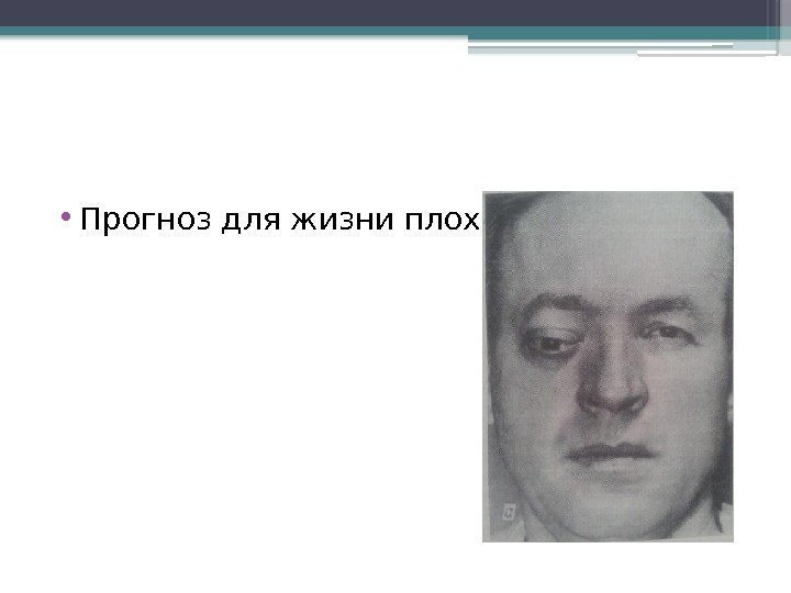  • Прогноз для жизни плохой     