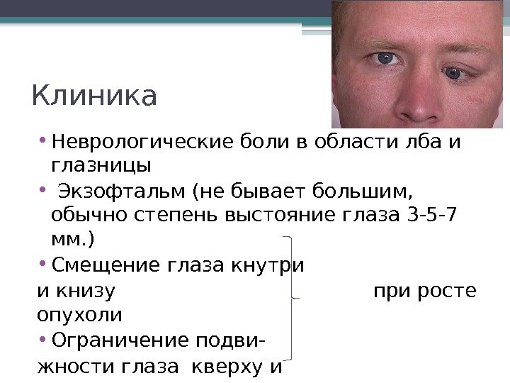 Клиника  • Неврологические боли в области лба и глазницы •  Экзофтальм (не