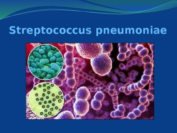 Streptococcus pneumoniae 