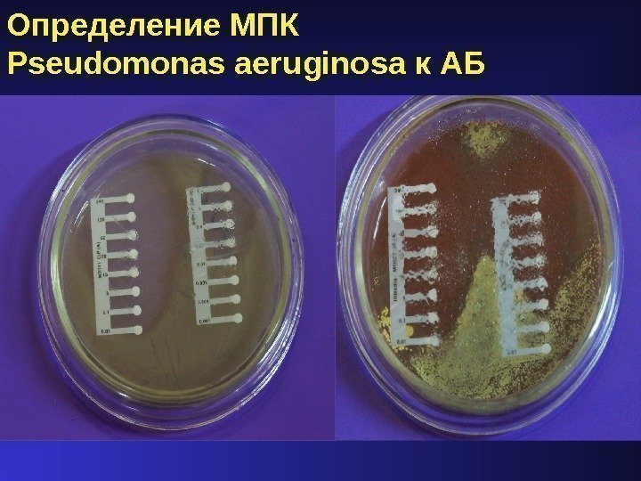 Определение МПК Pseudomonas aeruginosa к АБ 