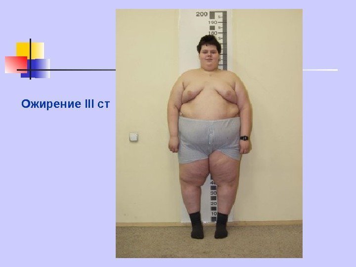   Ожирение III ст 