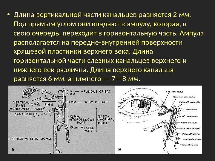 Горизонтальные части