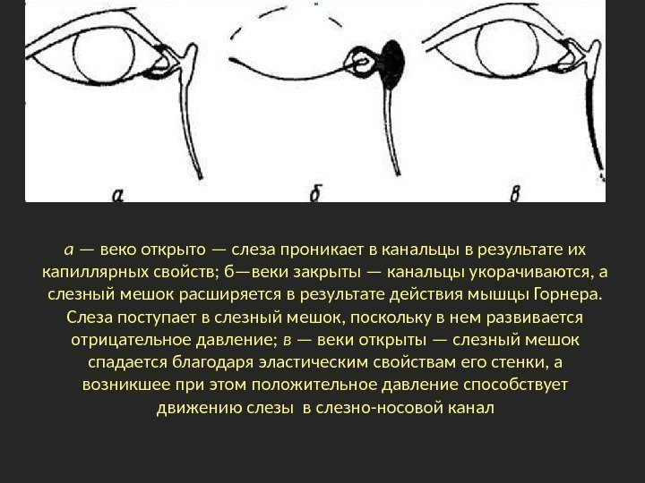 а — веко открыто — слеза проникает в канальцы в результате их капиллярных свойств;