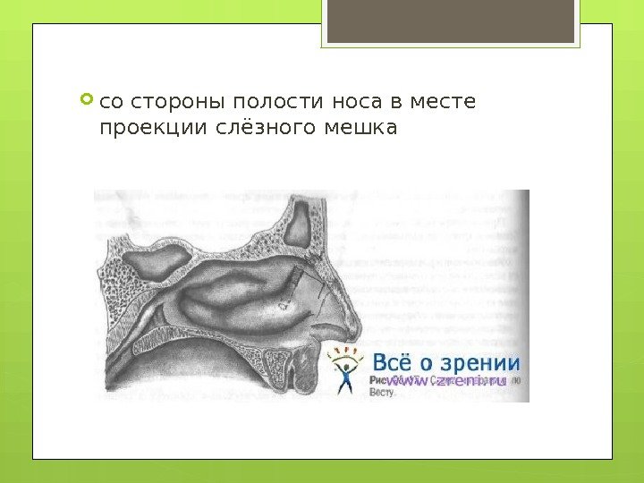  со стороны полости носа в месте проекции слёзного мешка    