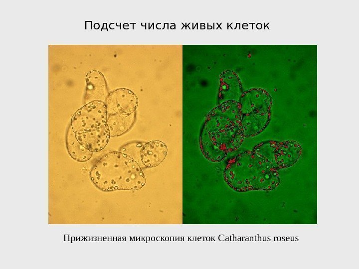  Прижизненная микроскопия клеток Catharanthus roseus Подсчет числа живых клеток 