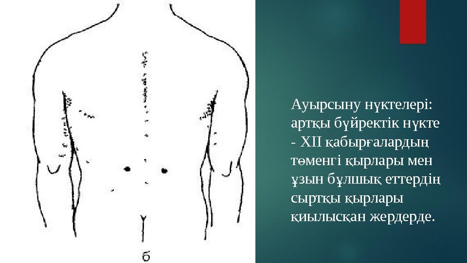 Ауырсыну н ктелері: ү арт ы б йректік н кте қ ү ү -