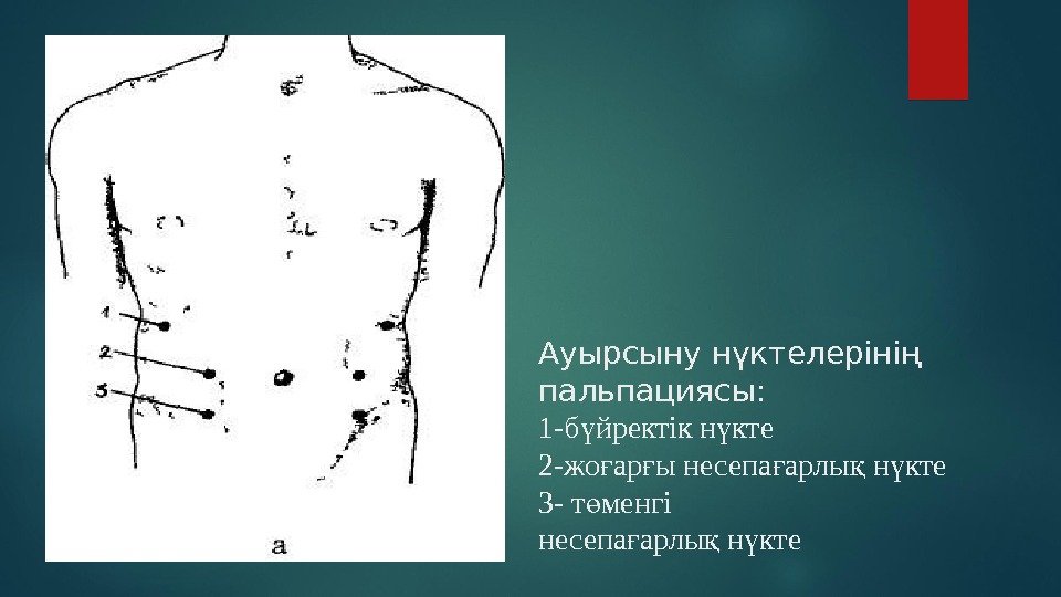 Ауырсыну нүктелерінің пальпациясы: 1 -б йректік н ктеү ү 2 -жо ар ы несепа