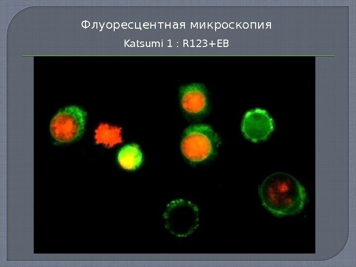 Флуоресцентная микроскопия Katsumi 1 : R 123+EB 