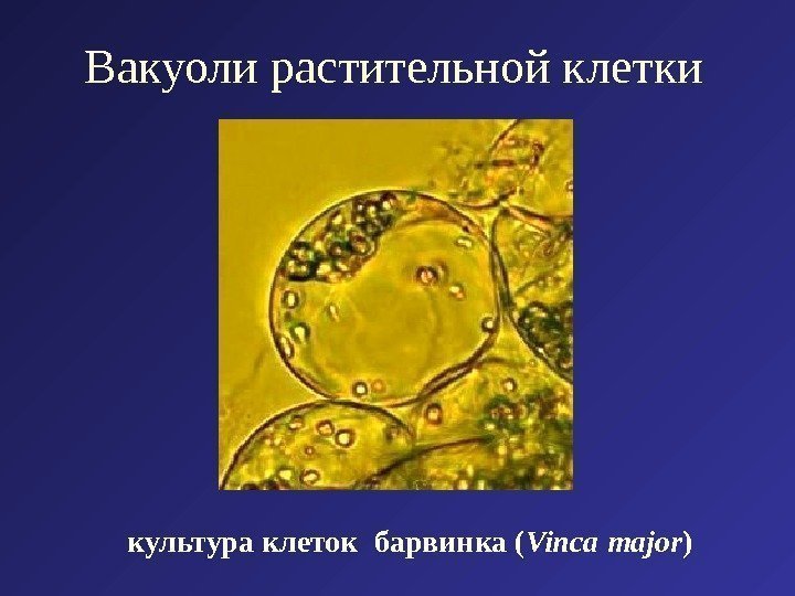 Вакуоли растительной клетки культура клеток  барвинка ( Vinca  major ) 