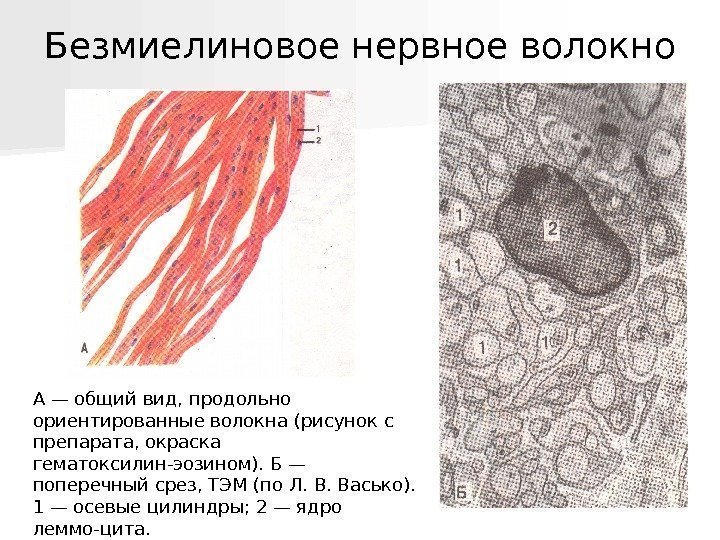  А — общий вид, продольно ориентированные волокна (рисунок с препарата, окраска гематоксилин-эозином).