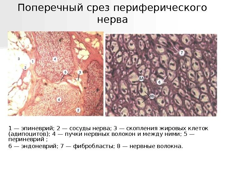  Поперечный срез периферического нерва 1 — эпиневрий; 2 — сосуды нерва; 3