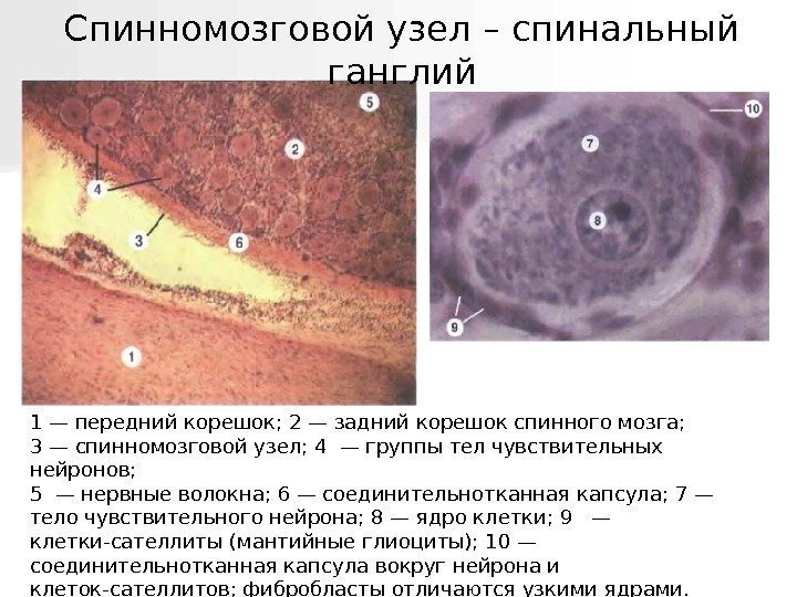   Спинномозговой узел – спинальный ганглий 1 — передний корешок; 2 — задний