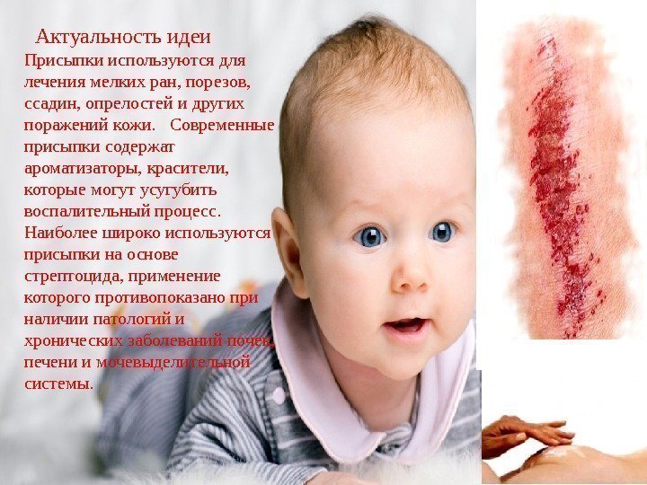    Актуальность идеи Присыпки используются для лечения мелких ран, порезов,  ссадин,