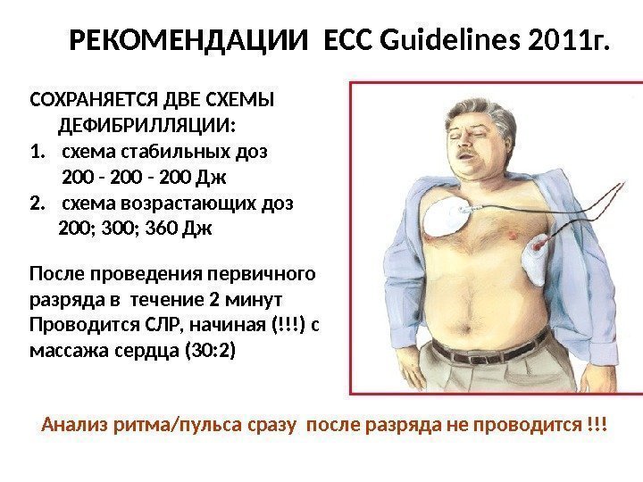 РЕКОМЕНДАЦИ И ECC Guidelines 20 11 г. СОХРАНЯЕТСЯ ДВЕ СХЕМЫ   ДЕФИБРИЛЛЯЦИИ :