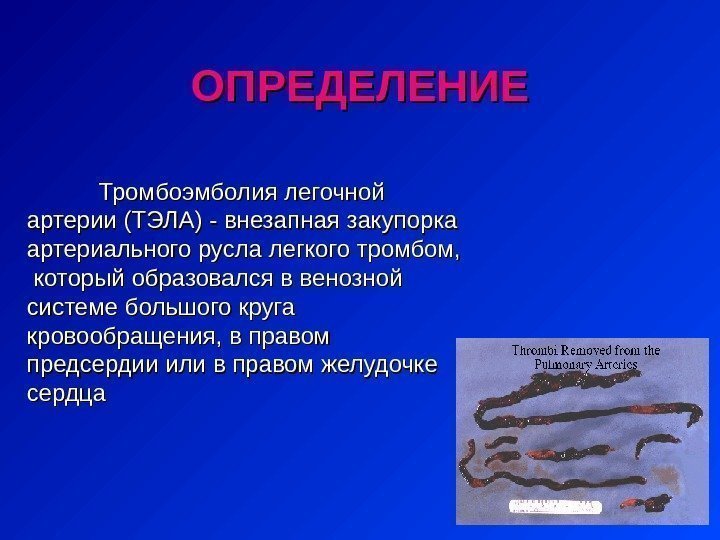 Тромбоэмболия легочной артерии ( ТЭЛА ))  - внезапная закупорка артериального русла легкого тромбом,