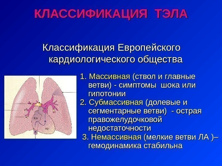 Классификация Европейского кардиологического общества 1. Массивная (( сс твол и главные ветви) - симптомы