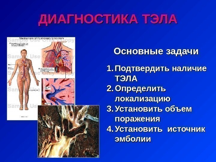 1. 1. Подтвердить наличие ТЭЛА 2. 2. Определить локализацию 3. 3. Установить объем поражения