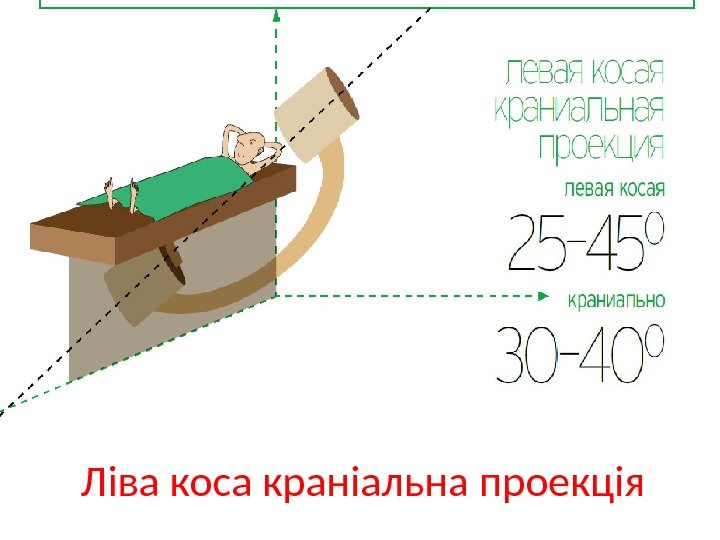 Ліва коса краніальна проекція 