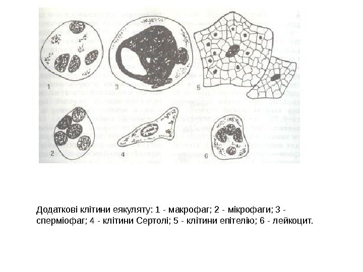 Додаткові клітини еякуляту: 1 - макрофаг; 2 - мікрофаги; 3 - сперміофаг; 4 -