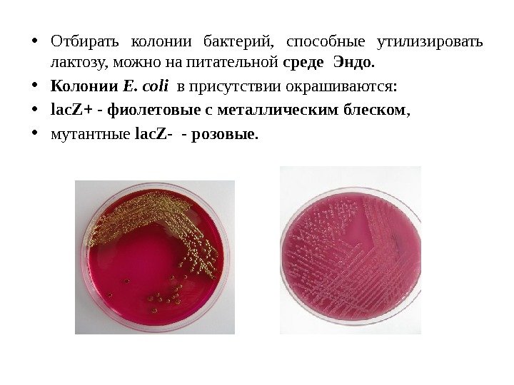  • Отбирать колонии бактерий,  способные утилизировать лактозу, можно на питательной среде Эндо.