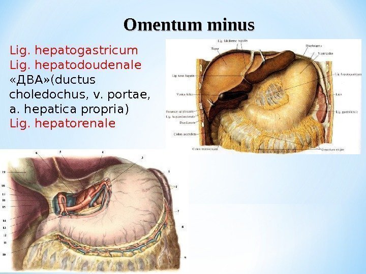 Omentum minus Lig. hepatogastricum Lig. hepatodoudenale «ДВА» (ductus choledochus, v. portae,  a. hepatica