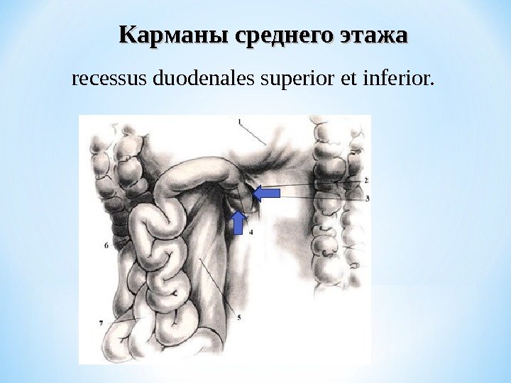 Карманы среднего этажа recessus duodenales superior et inferior. 