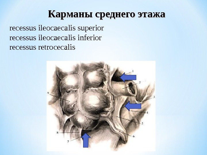 Карманы среднего этажа recessus ileocaecalis superior recessus ileocaecalis inferior recessus retrocecalis 
