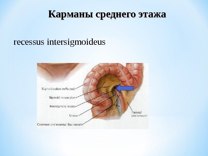 Карманы среднего этажа recessus intersigmoideus 