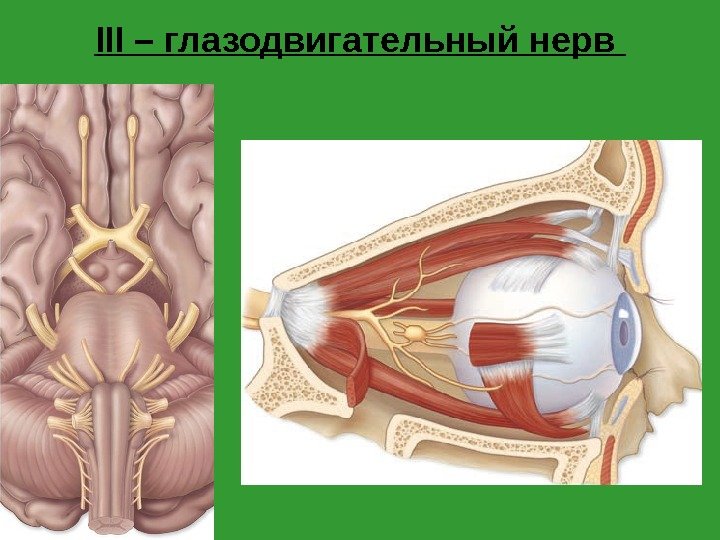 III – глазодвигательный нерв 