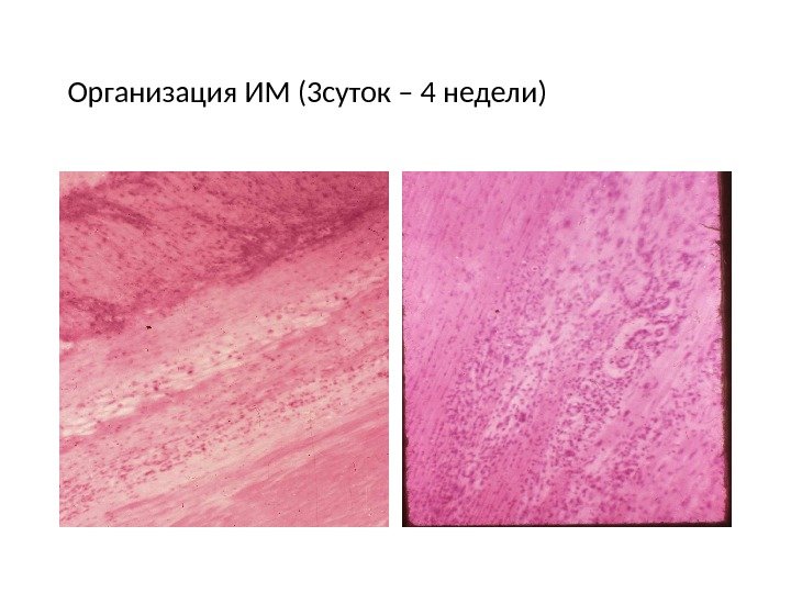 Организация ИМ (3 суток – 4 недели) 