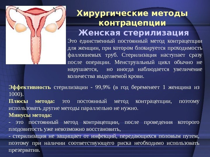 Хирургические методы контрацепции  Женская стерилизация Эффективность  стерилизации - 99, 9 (в год