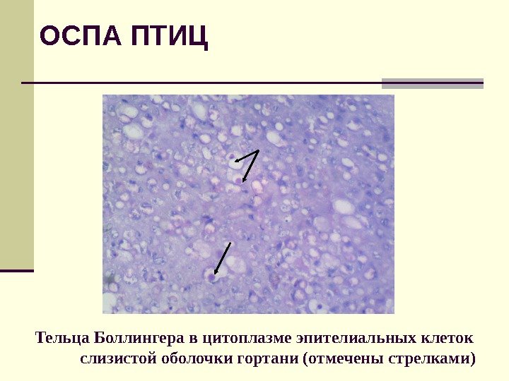 Тельца Боллингера в цитоплазме эпителиальных клеток слизистой оболочки гортани (отмечены стрелками)ОСПА ПТИЦ 