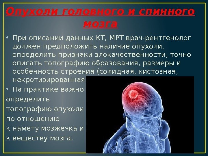 Опухоли головного и спинного мозга • При описании данных КТ, МРТ врач-рентгенолог должен предположить