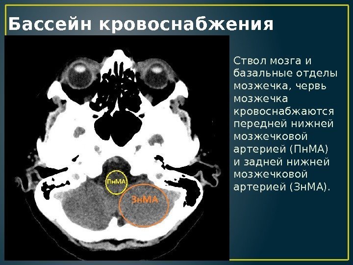 Бассейн кровоснабжения Ствол мозга и базальные отделы мозжечка, червь мозжечка кровоснабжаются передней нижней мозжечковой