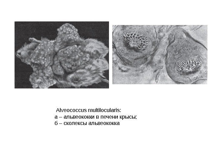  Alveococcus multilocularis: а – альвеококки в печени крысы; б – сколексы альвеококка 