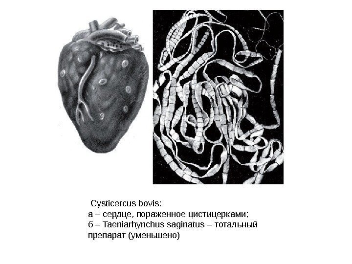  Cysticercus bovis: а – сердце, пораженное цистицерками; б – Taeniarhynchus saginatus – тотальный