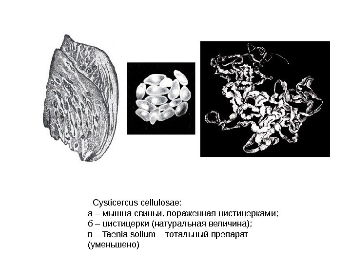   Cysticercus cellulosae: а – мышца свиньи, пораженная цистицерками; б – цистицерки (натуральная