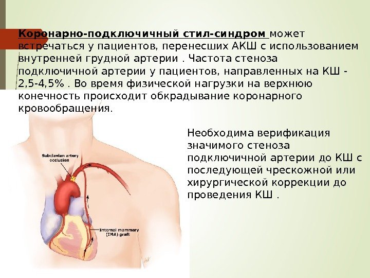 Коронарно-подключичный стил-синдром может встречаться у пациентов, перенесших АКШ с использованием внутренней грудной артерии. Частота